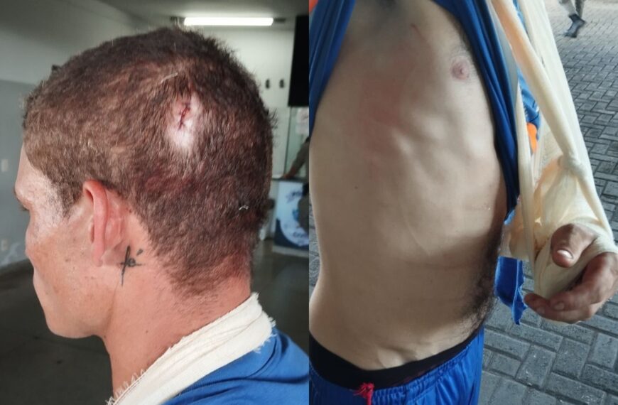Briga de funcionários termina com corte na cabeça e braço quebrado, em Goiânia 
