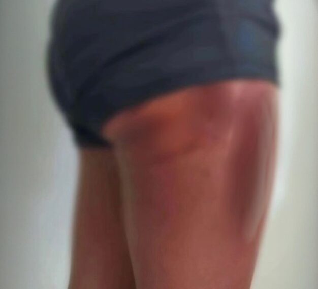 Mulher pula de carro em movimento para fugir de companheiro agressor, em Jataí 