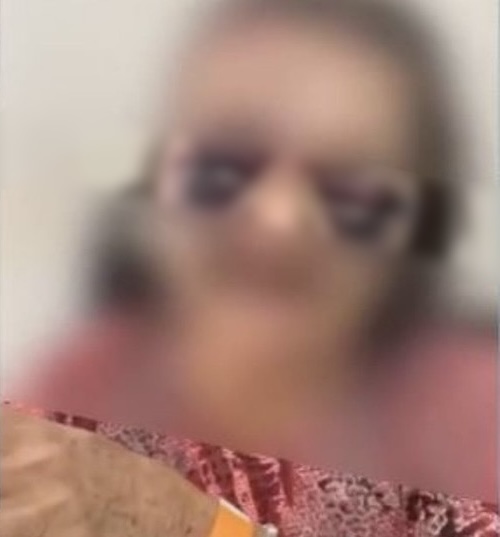 Cuidadora é presa suspeita de espancar idosa durante banho 