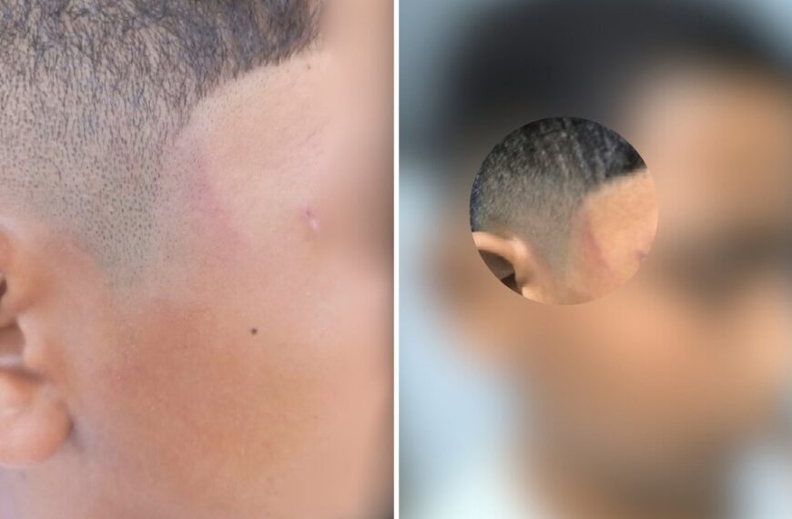 Criança autista é xingada agredida por médico, denuncia mãe